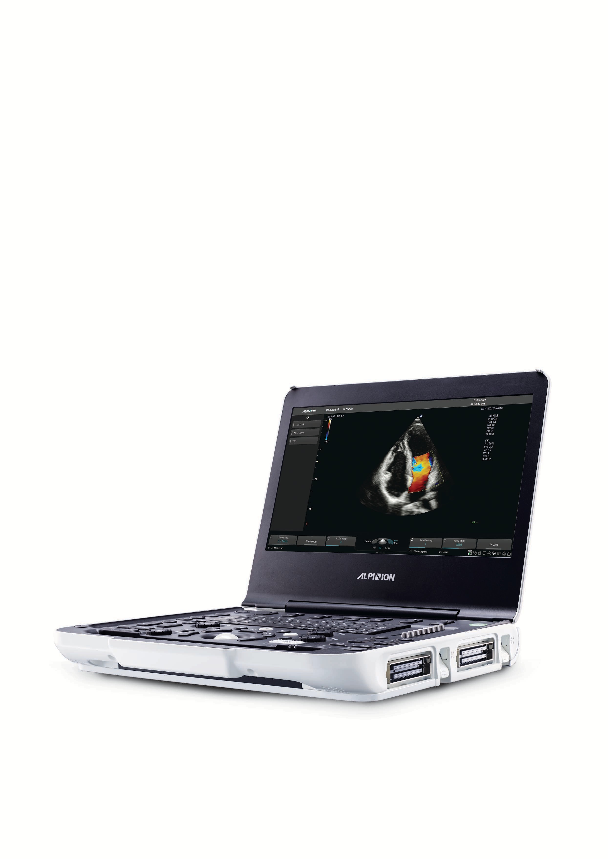 X-CUBE i9 (Alpinion) — Laptop-style Portable USG